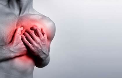 Infarto
